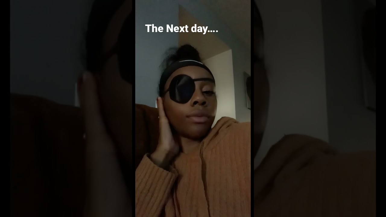 Lol always wear protective Eye gear. Was In a eye patch for a week 😭😭🤣🤣🤣 My bad…