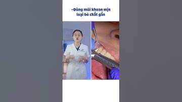 Quy trình tháo mắc cài trong niềng răng ??? | Lạc Việt Intech Niềng Răng #shorts