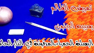 ت_مريض الظالم و خروج عقله بالعذ.اب الشدبد بالبصلة الحمراء فتق الله لا تعمله إلا لمستحقيه