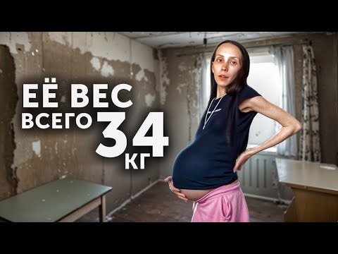 Видео: ЕЁ ВЕС ВСЕГО 34 КГ И ОНА РОДИЛА ЧЕТВЕРЫХ...