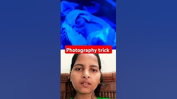 #phototherapy given trick newborn baby #jaundice treatment #tips#hospital shorts #