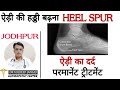 Best homoeopathy treatment of heel spur              