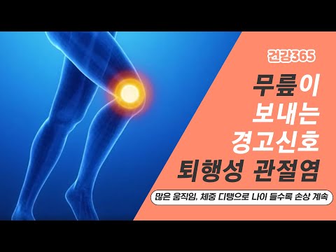 무릎이 보내는 경고 신호, 퇴행성 관절염 [TBC클리닉건강365]