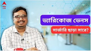Varicose Veins: ভ‍্যারিকোজ ভেনস কী? অপারেশন ছাড়া সারে? জানাচ্ছেন Avis Vascular Centre এর চিকিৎসক