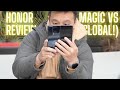 Why the Honor Magic Vs getting a global launch is important! (Review).