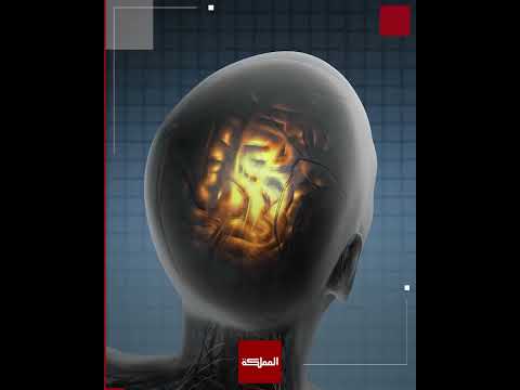 دراسة أميركية تكشف نشاطا دماغيا للإنسان شبيها بالوعي وهو في مرحلة الاحتضار