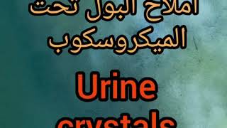 املاح البول تحت الميكروسكوب urine crystals