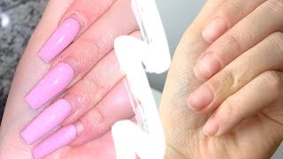 How To Remove Acrylic Nails At Home - DO NOT RIP THEM OFF!! How To Correctly Remove Acrylic Nails Do Not Bite Them Off