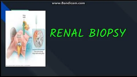 Renal Biopsy: Indication, contraindication, Procedure and complications - DayDayNews