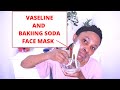 Apply Vaseline And Baking soda for Ance Free | Skin Brightening Face mask