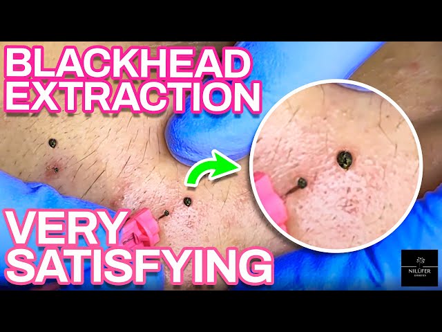 Satisfying Extractions