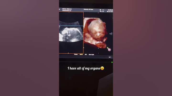 ربنا يرزق كل مشتاق بالذرية الصالحه يارب❤أمال أبو المجد