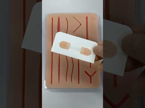 Zip Tie Stitching