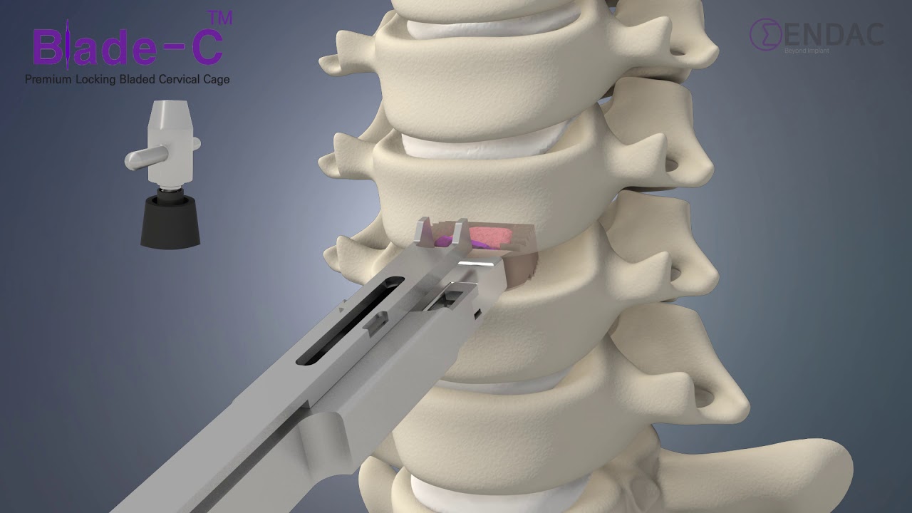 ENDAC BLADE-C(Premium Cervical Locking Bladed Cage)