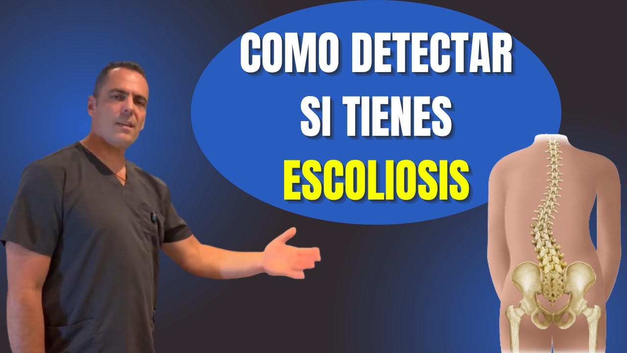 Como puedes DETECTAR si tienes ESCOLIOSIS? 