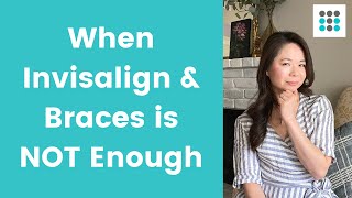 WHEN INVISALIGN/BRACES ALONE IS NOT ENOUGH l Dr. Melissa Bailey Orthodontist