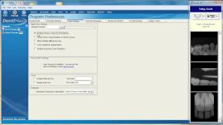 Changing the Clinical Charting Screen | DentiMax Dental Software Tip