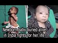 Newborn baby buried alive in India fights for her life