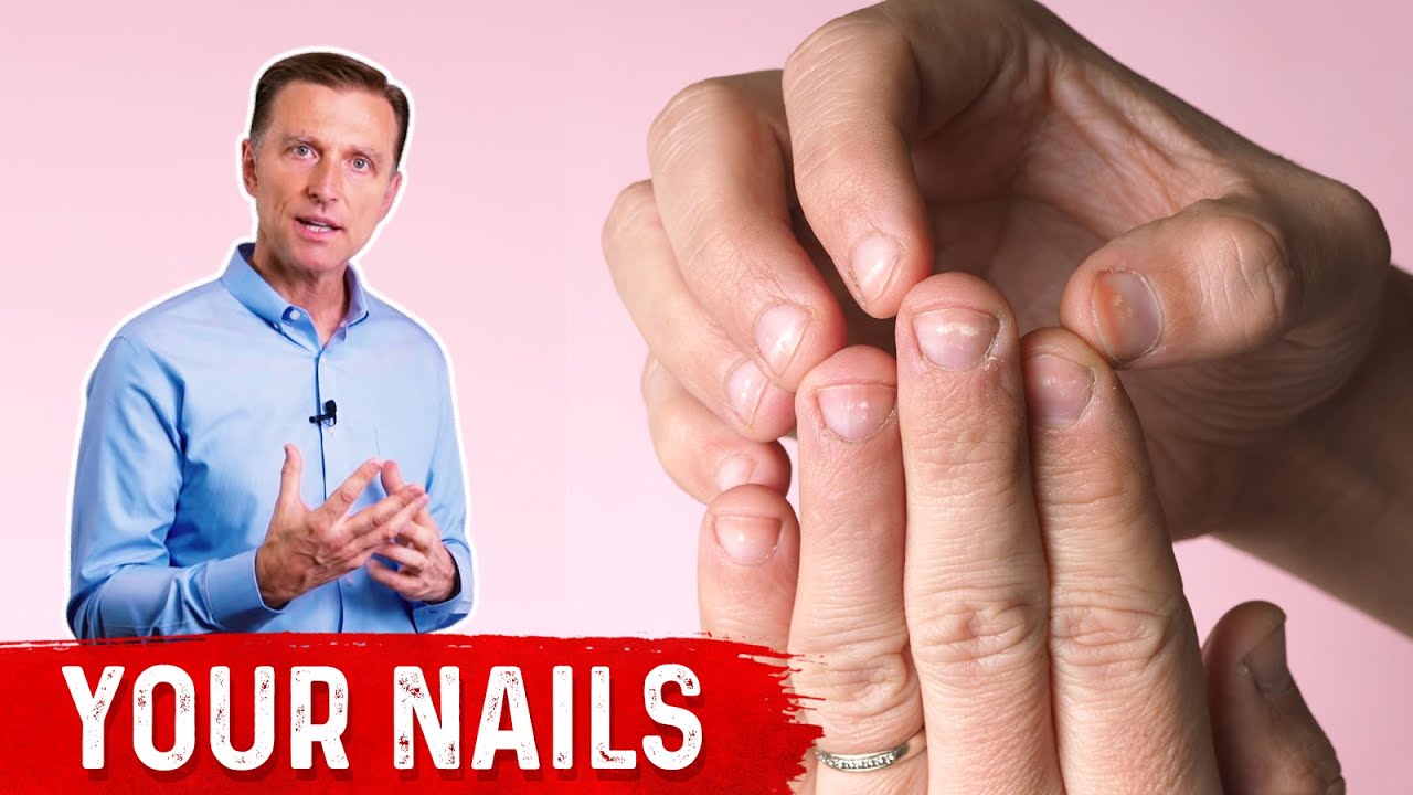 A Day in the Life of a Nail Expert | Nails, White nails, Nail disorders