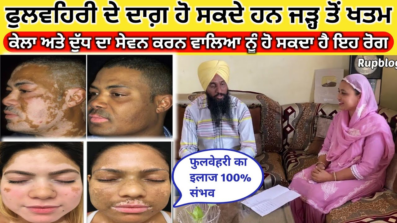 फुलवेहरी को कैसे करे ठीक इलाज 100% संभव ! ਫੋਲੈਰੀ ਨੂੰ ਵੀ ਕਰ ਸਕਦੇ ਹਾਂ ਠੀਕ! Folari ka  Treatment 100%