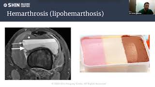 Musculoskeletal & Soft Tissue Injury Webinar (Part 2) screenshot 4