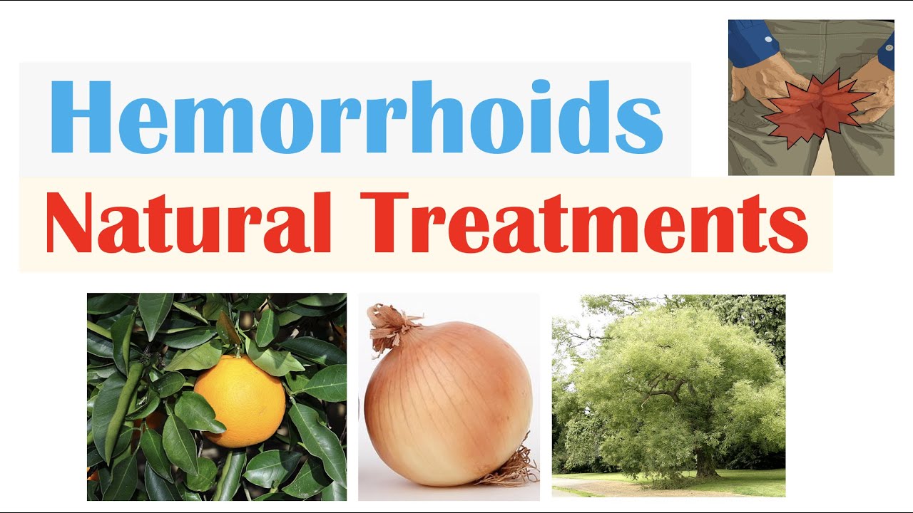 How To Treat Hemorrhoids 9 Natural Treatments Plant Flavonoids For Hemorrhoidal Disease