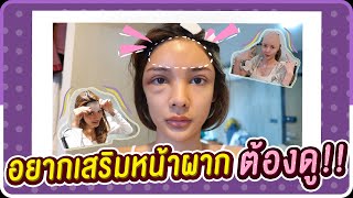 อยากเสริมหน้าผากต้องดู