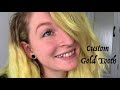 Getting A Custom Gold Tooth Cap Getting A Custom Gold Tooth Cap