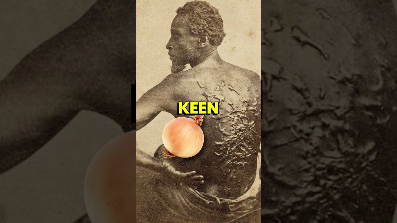 Meet the Man Who Cheated Death TWICE | The Big Fact