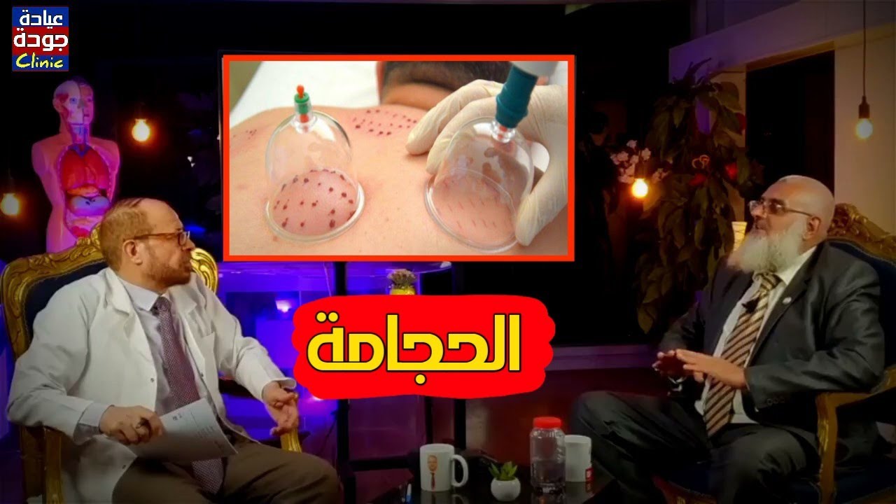الحجامة : ما لا تعرفه عنها وشروطها وعددها | دكتور جودة محمد عواد | دكتور جودة محمد عواد