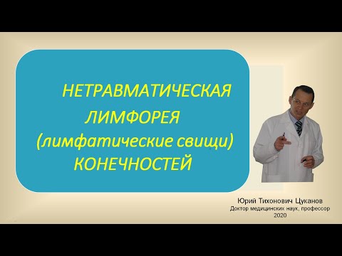 Нетравматическая лимфорея (лимфатические свищи) конечностей. Лекция для врачей.