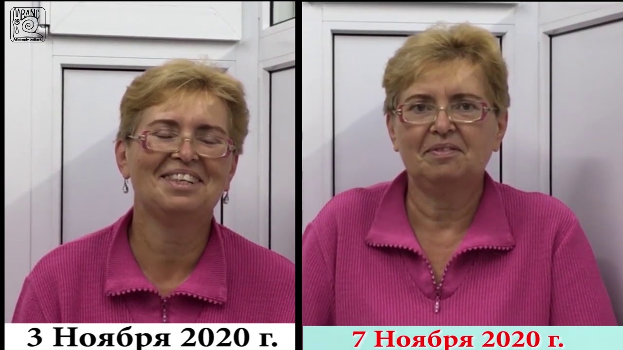 Болезнь паркинсона метод ранс а а пономаренко - фото презентация