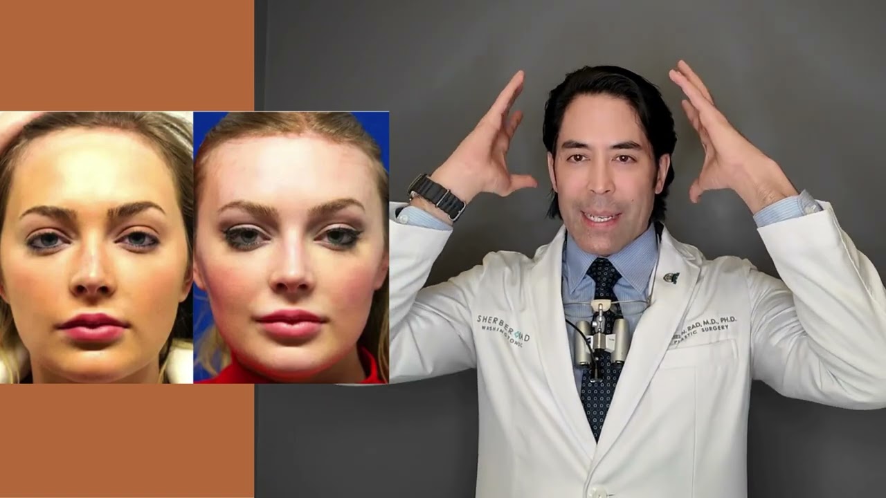 FOREHEAD REDUCTION HAIRLINE LOWERING