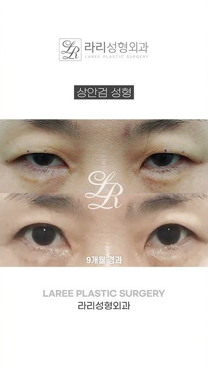 라리두잇 - Youtube