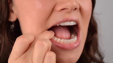 Clear Correct - How clear aligners work