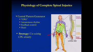 Recovery of the Function in Major Spinal Cord Injury Using Epidural Stimulation Aug  24, 2013
