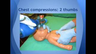 Resuscitation of Newborn Infants