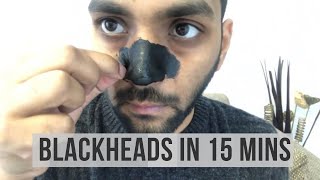 How to Remove Blackheads And Whiteheads From Nose Naturally at Home | ANKIT TV