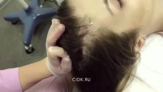Пилинг и ультразвуковая чистка кожи головы в ЦИДК