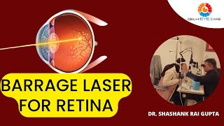 Barrage Laser Barrage Laser For Retina Holes, Lattice & Horseshoe Tear