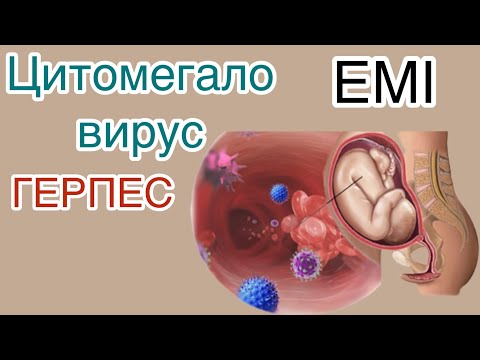 Video: Ласса вирусу деген эмне?