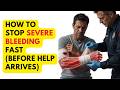 How To Stop Severe Bleeding Fast (Before Help Arrives)