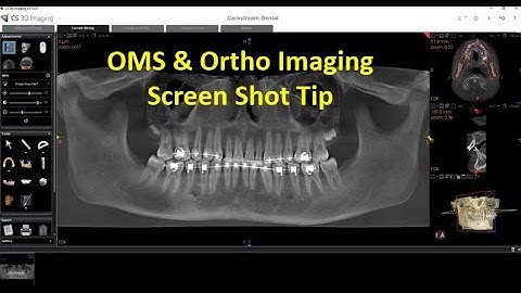 CS 3D Imaging Software Screen Shots Tip