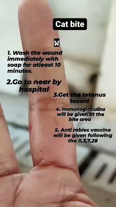 had  a cat bite.. here's wat to do #rabies #cat #veterinarydoctor