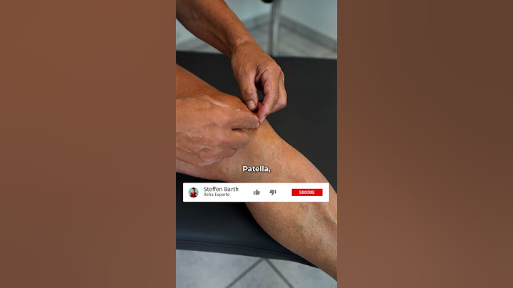 Schnelle Hilfe bei Knieschmerzen | So behandelst du Knie Beschwerden richtig!