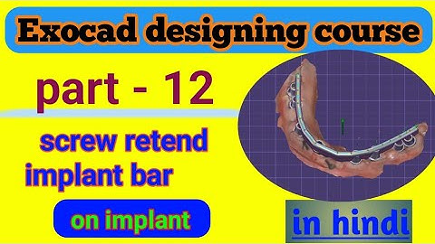 "Exocad Dental Bar Design for Implants | Screw Retained Bar Explained in Hindi"