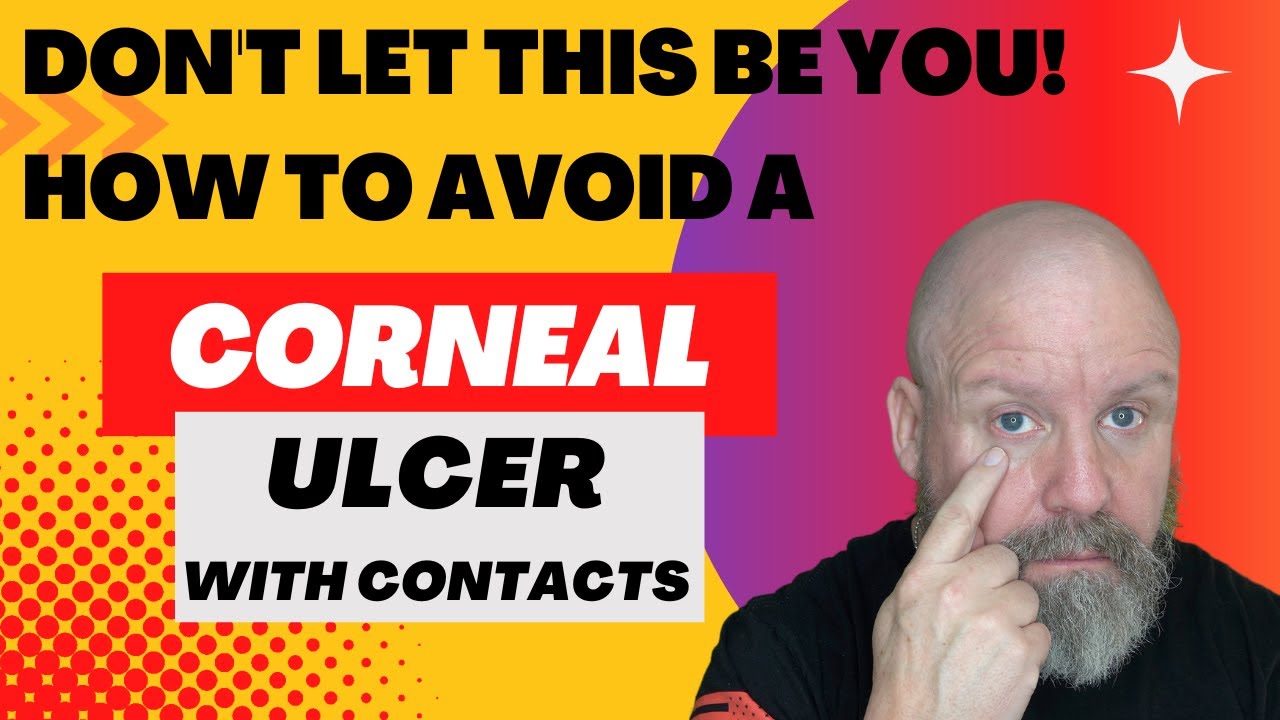 Don't Let This Be You! How to Avoid a Corneal Ulcer 