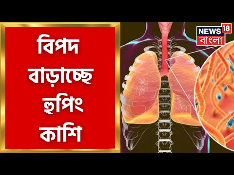 ভিডিও: কে হুপিং কাশি হয়?