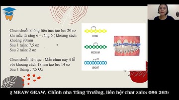 Thun Đơn, Thun Liên Hàm Trong Chỉnh Nha