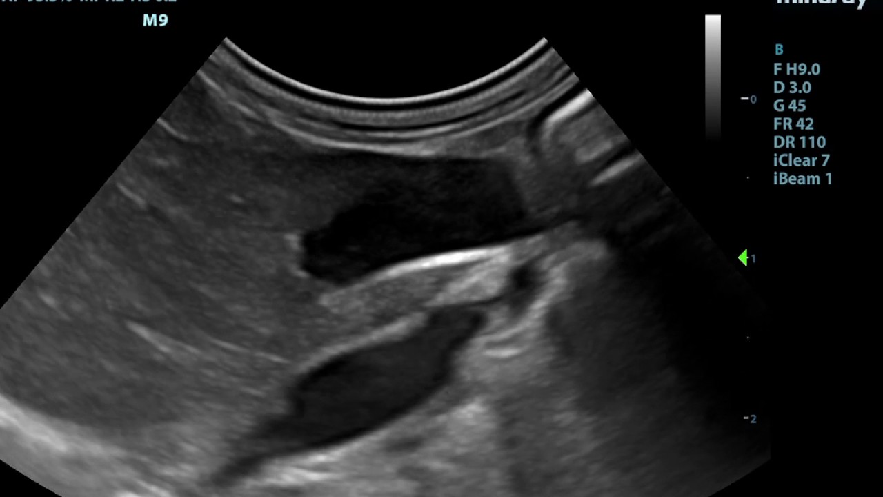 Small Animal Ultrasound YouTube